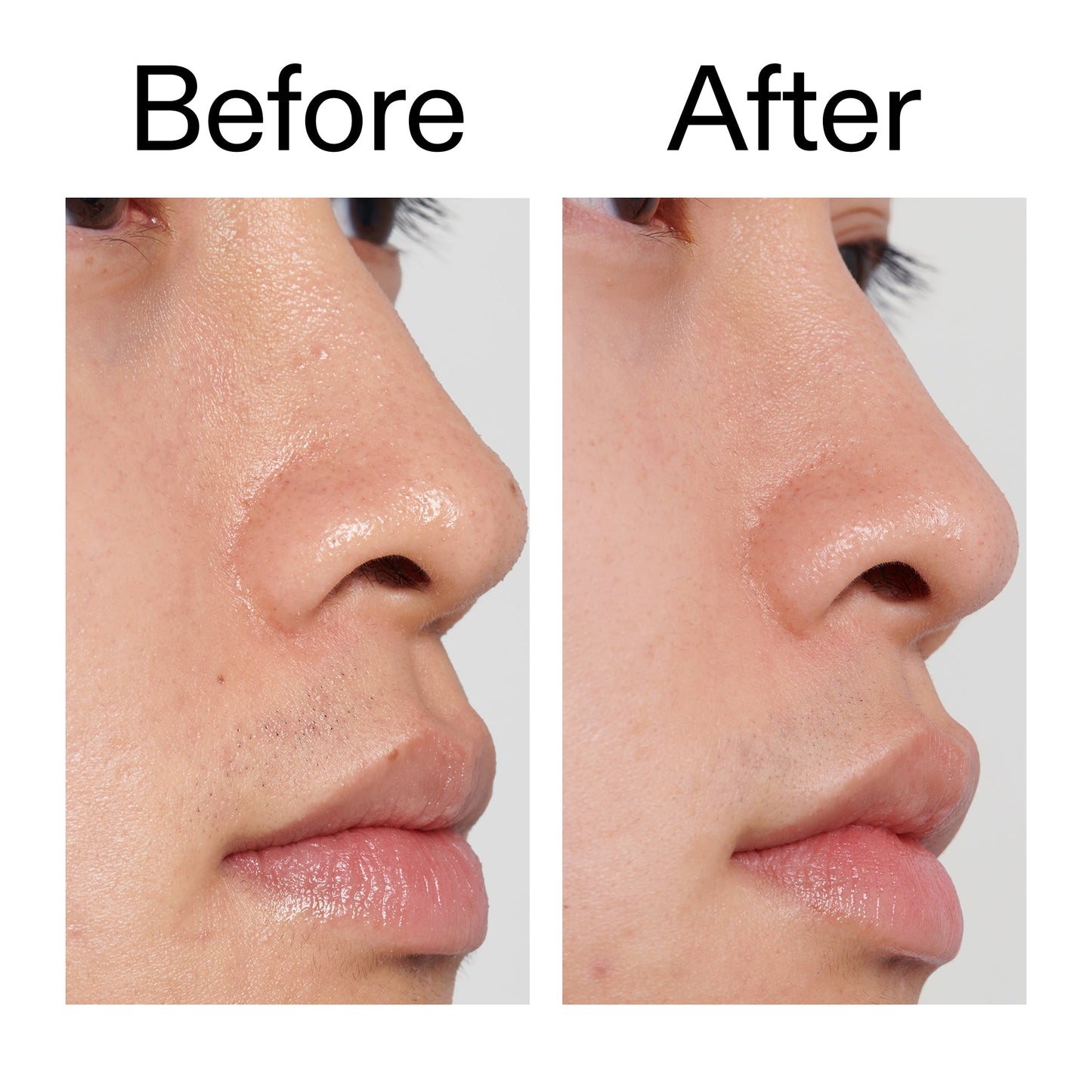 pha-toner-s6 PHA_Toner_Before_After_2000x2000_e3c10172-0150-4342-8b95-57417eaff50d.jpg
