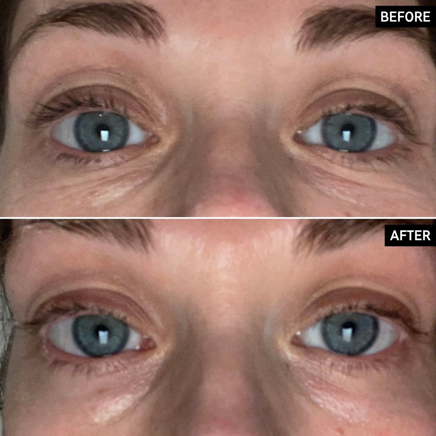 retinol-eye-cream-p8 SITE-UGCBAsApril_Nicole_B_A_PPage_2000x2000_1.jpg