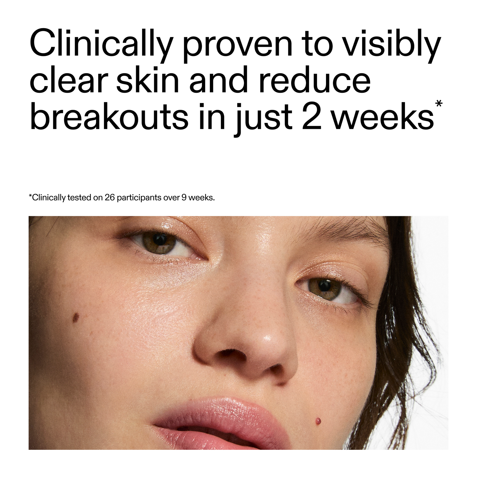 360-acne-clearing-duo-k6 360_Serum_Key_Claim.png