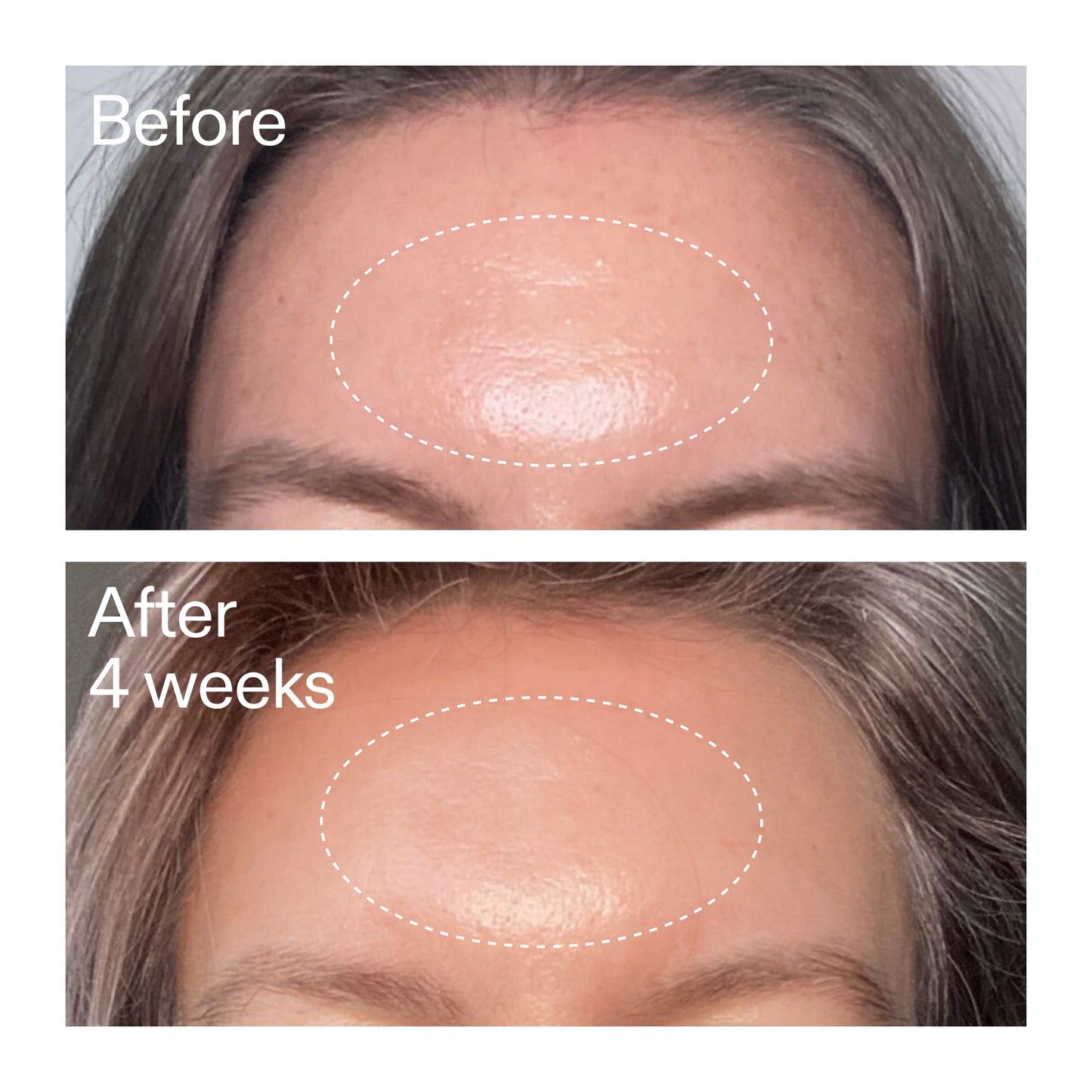 advanced-0-2-retinal-serum-f4 AdvancedRetinal_BeforeAfter1_2000x2000_1da6bb0a-29dd-41d1-95b7-8679696bbf0f.jpg