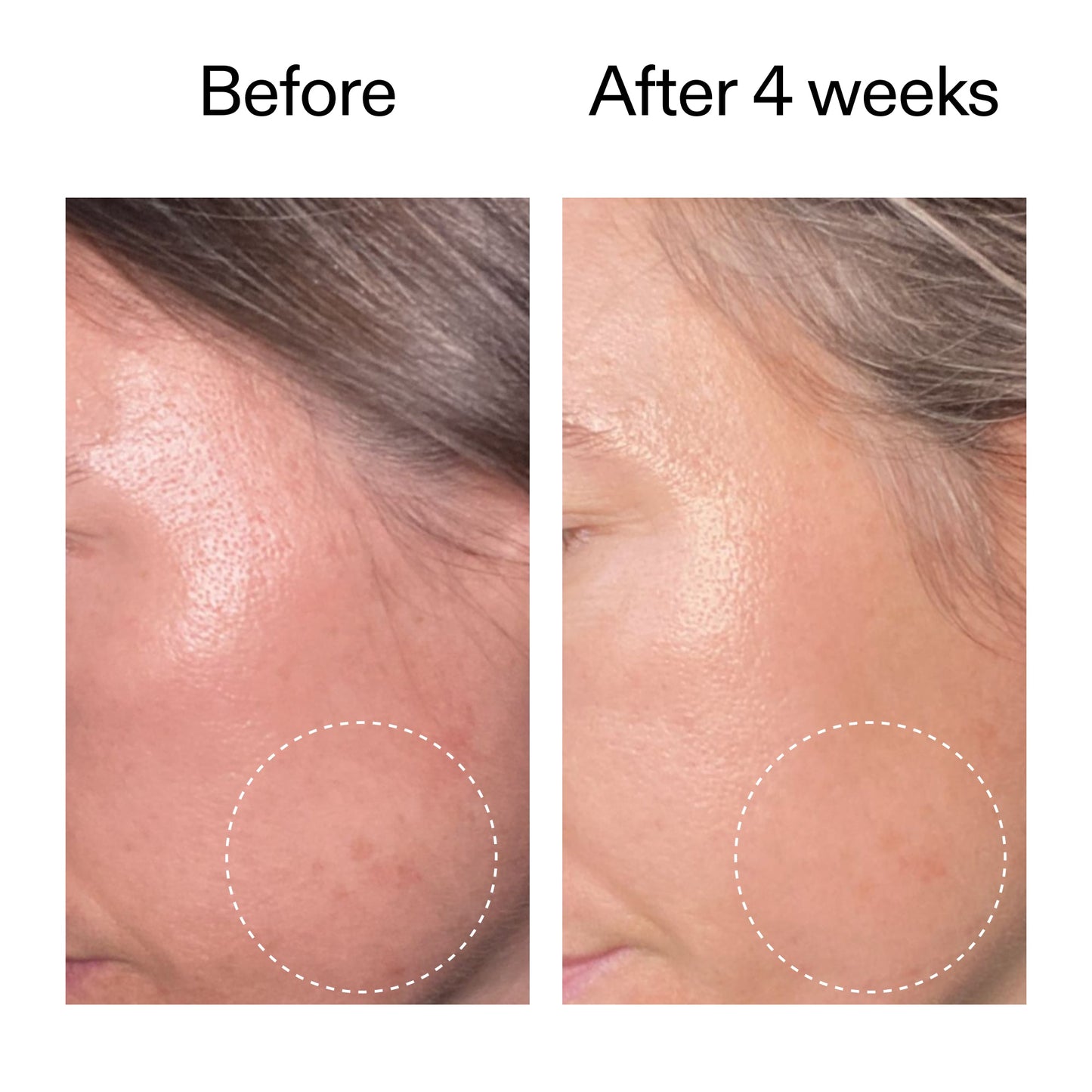 advanced-0-2-retinal-serum-f4 AdvancedRetinal_BeforeAfter2__2000x2000_62fb16bb-77ae-4d63-8500-88dbf847f4b9.jpg