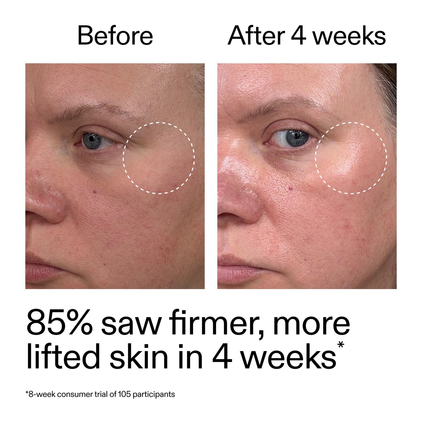 advanced-0-2-retinal-serum-f4 AdvancedRetinal_BeforeAfter_Claim1_2000x2000_bcc385c4-5e73-4f1e-aba8-64267937d0d3.jpg