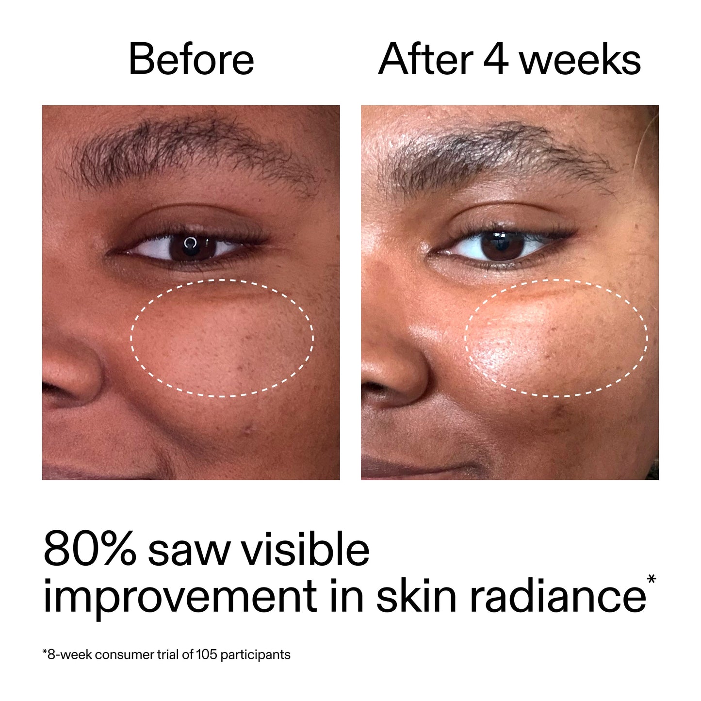 advanced-0-2-retinal-serum-duo-b2 AdvancedRetinal_BeforeAfter_Claim2_2000x2000_681b621d-8d44-4d44-9a40-89244f9b2e53.jpg