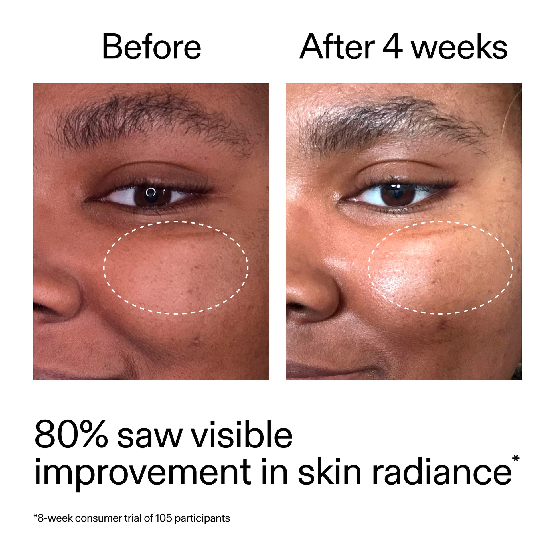 advanced-0-2-retinal-serum-duo-b2 AdvancedRetinal_BeforeAfter_Claim2_2000x2000_681b621d-8d44-4d44-9a40-89244f9b2e53.jpg