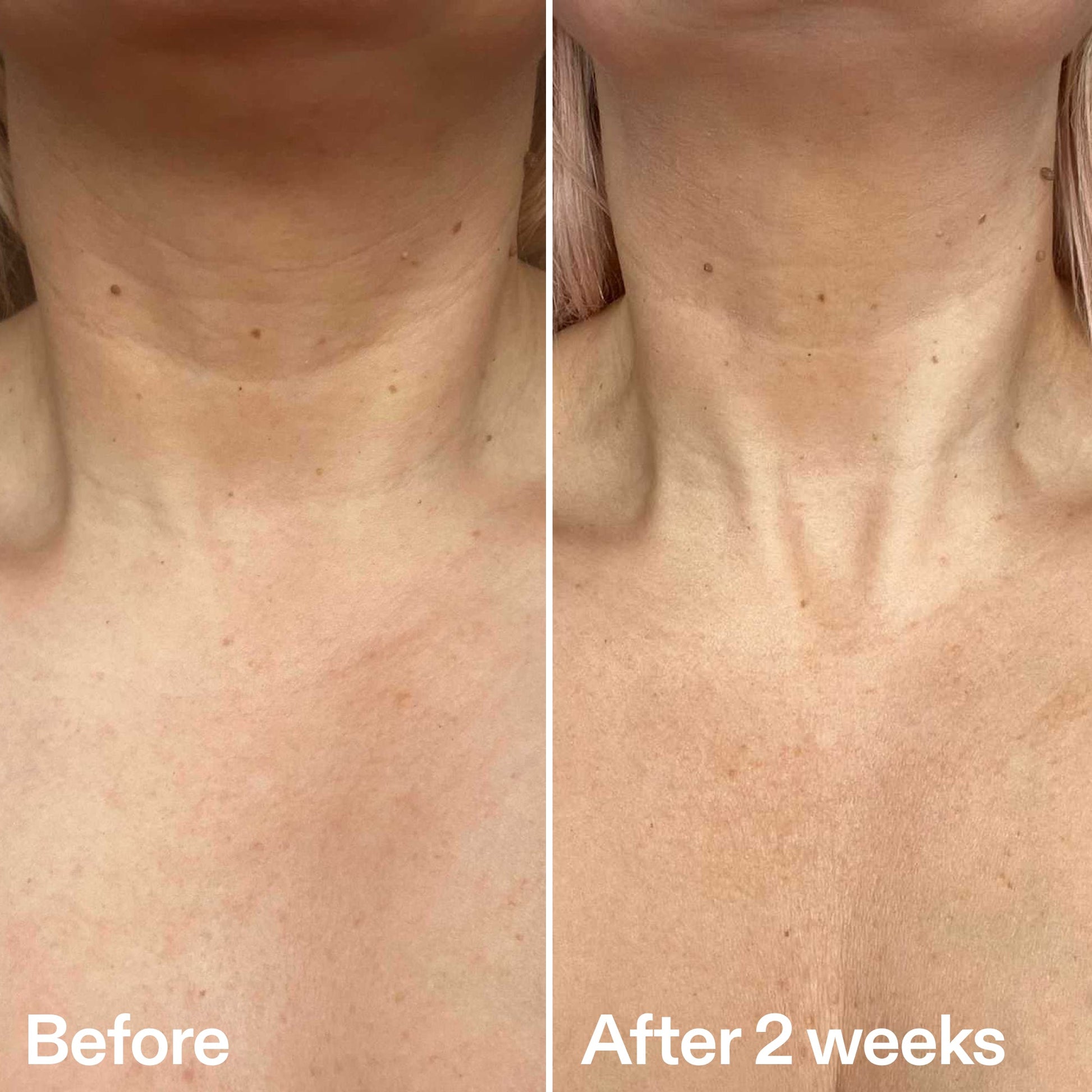 bio-active-neck-lift-stick-s8 B_A_2.jpg