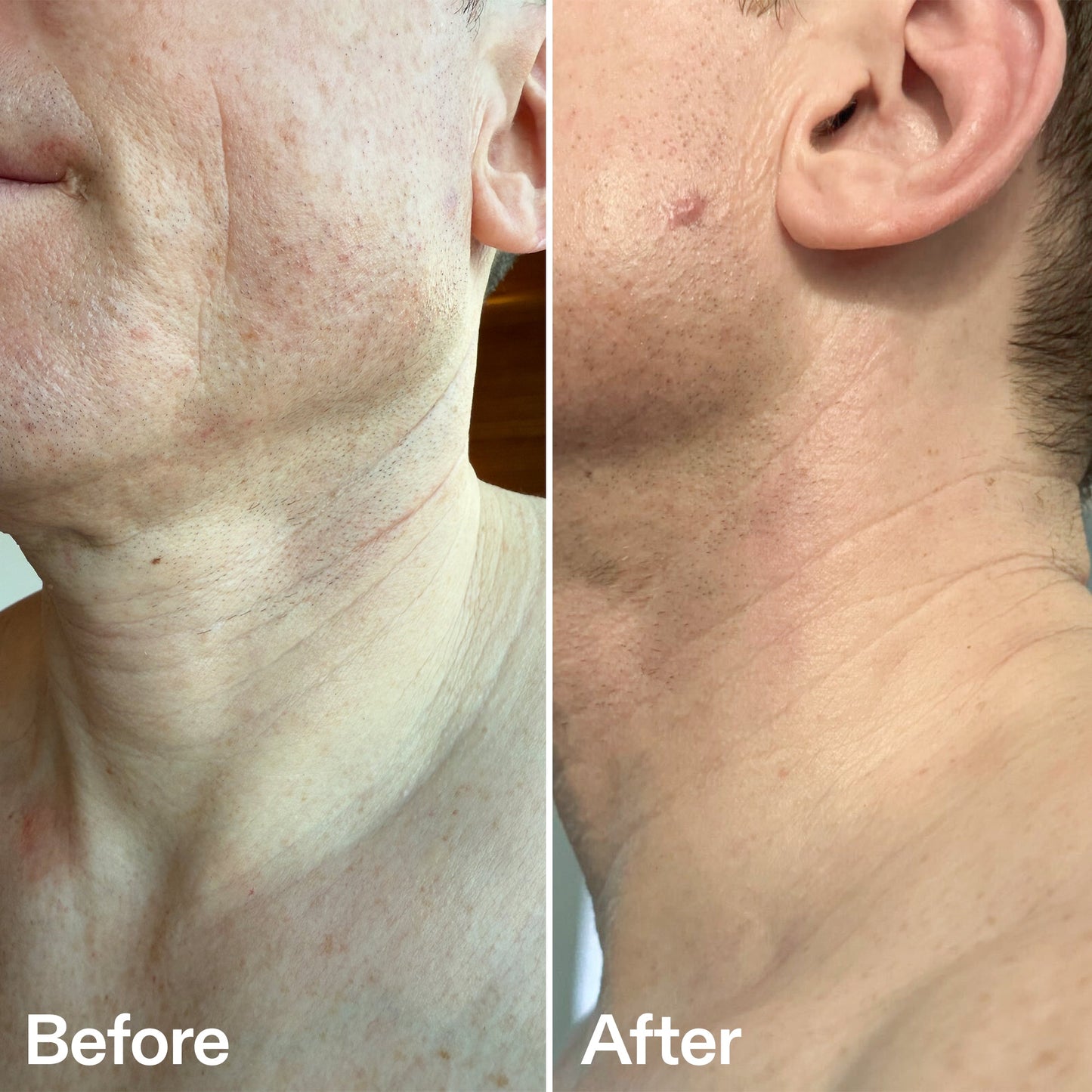 bio-active-neck-lift-stick-s8 B_A_afa2743e-b8e2-4504-92f4-e281cb6cf759.jpg