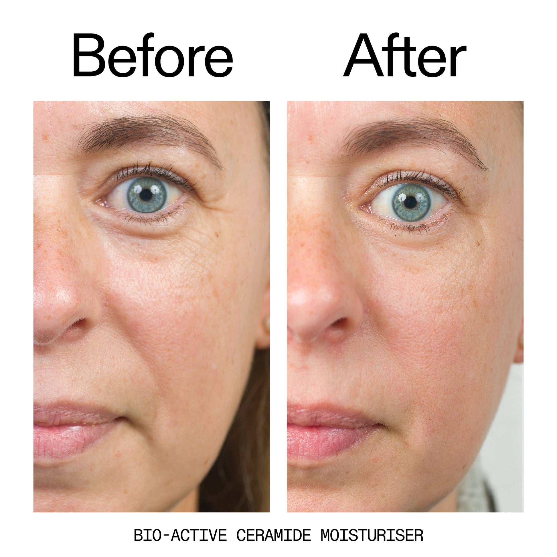 barrier-boosting-trio-w6 Bio-Active_Before_After_2000x2000_600947b4-e8c5-425a-9155-fc15bc83aa12.jpg