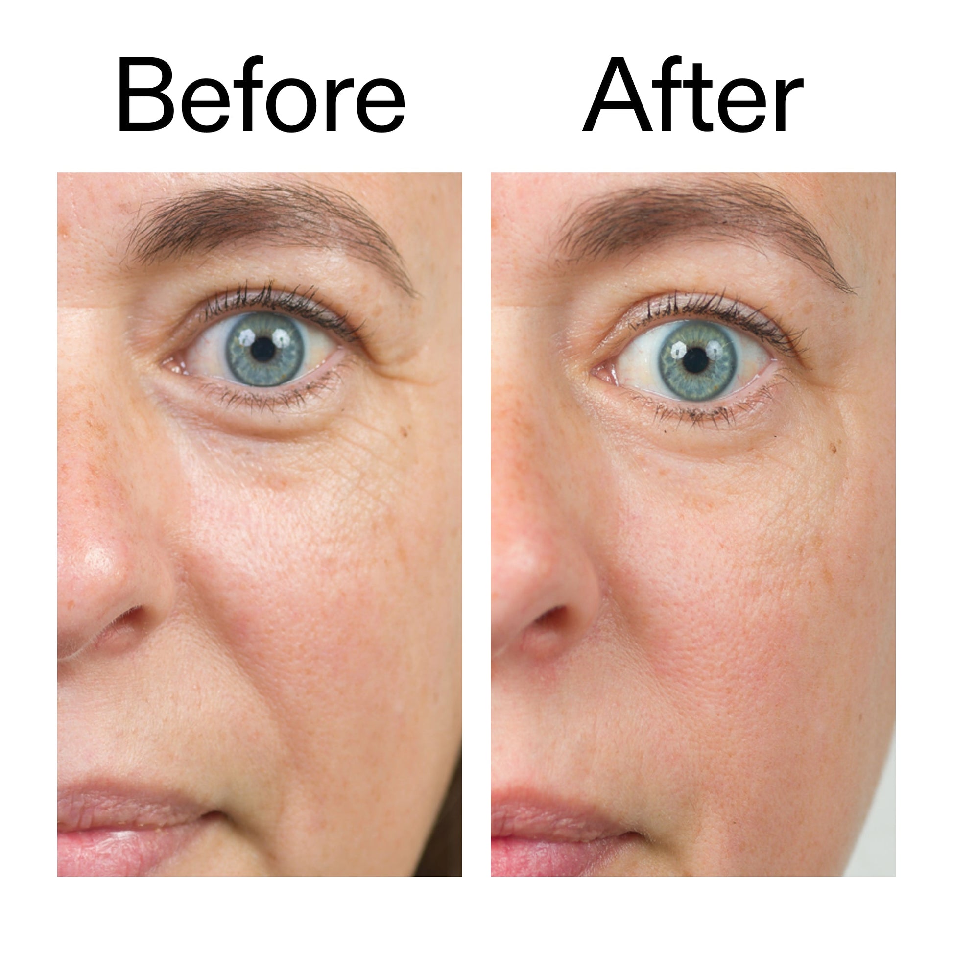 bio-active-ceramide-moisturizer-o8 Bio-Active_Before_After_2000x2000_566e5a9e-135e-417a-8242-b44e5fa35463.jpg