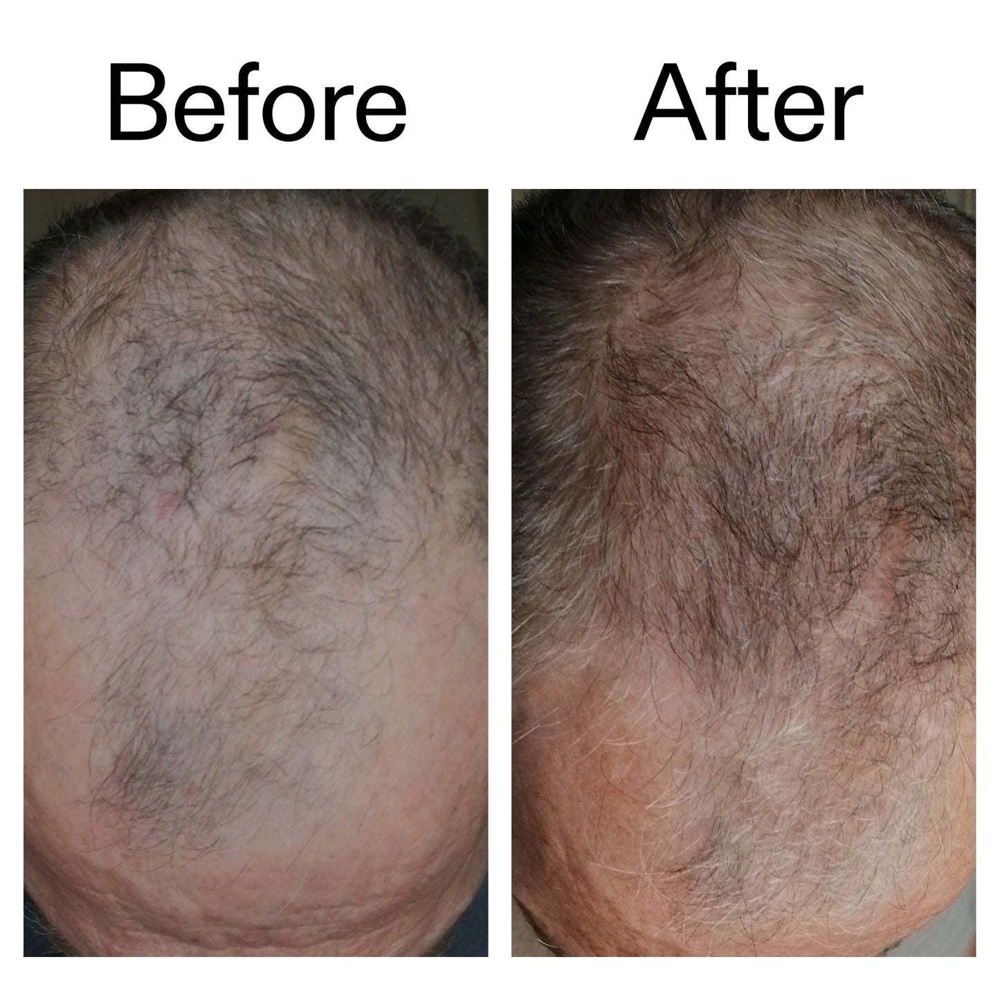 caffeine-stimulating-scalp-treatment-b8 Caffeine_Scalp_Treatment_B_A_Ppage_2000_x_2000.jpg