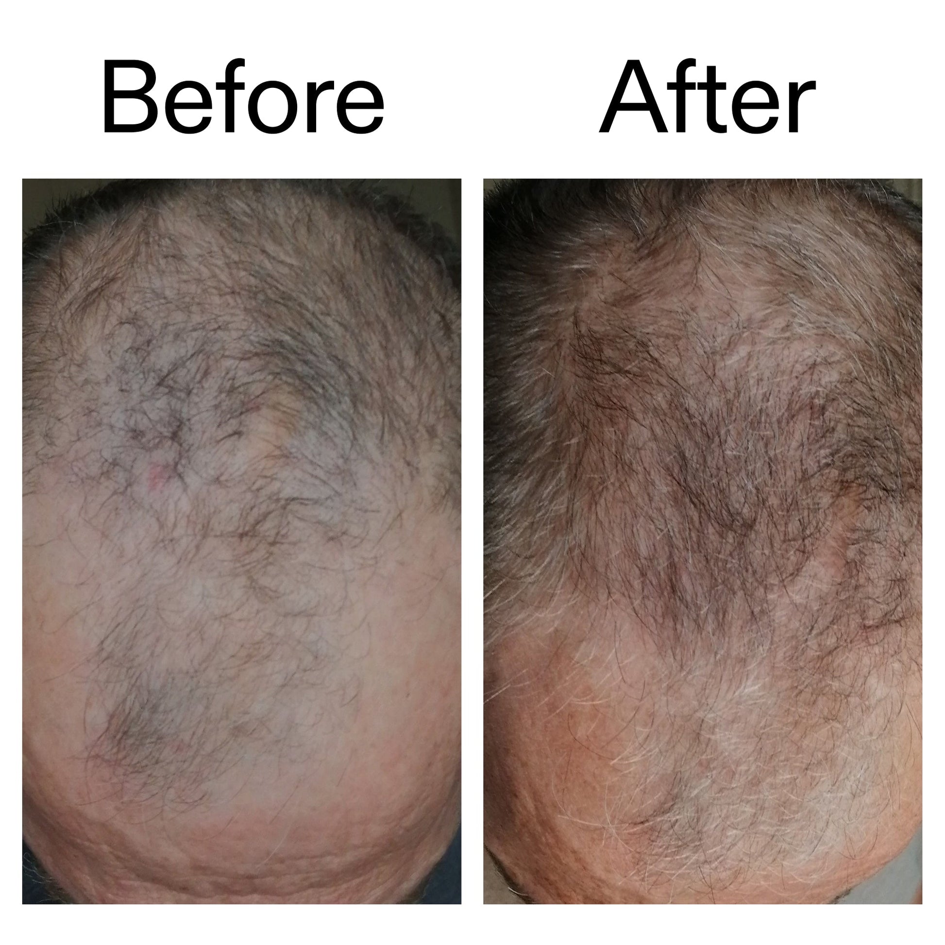 caffeine-stimulating-scalp-treatment-b8 Caffeine_Scalp_Treatment_B_A_Ppage_2000_x_2000.jpg