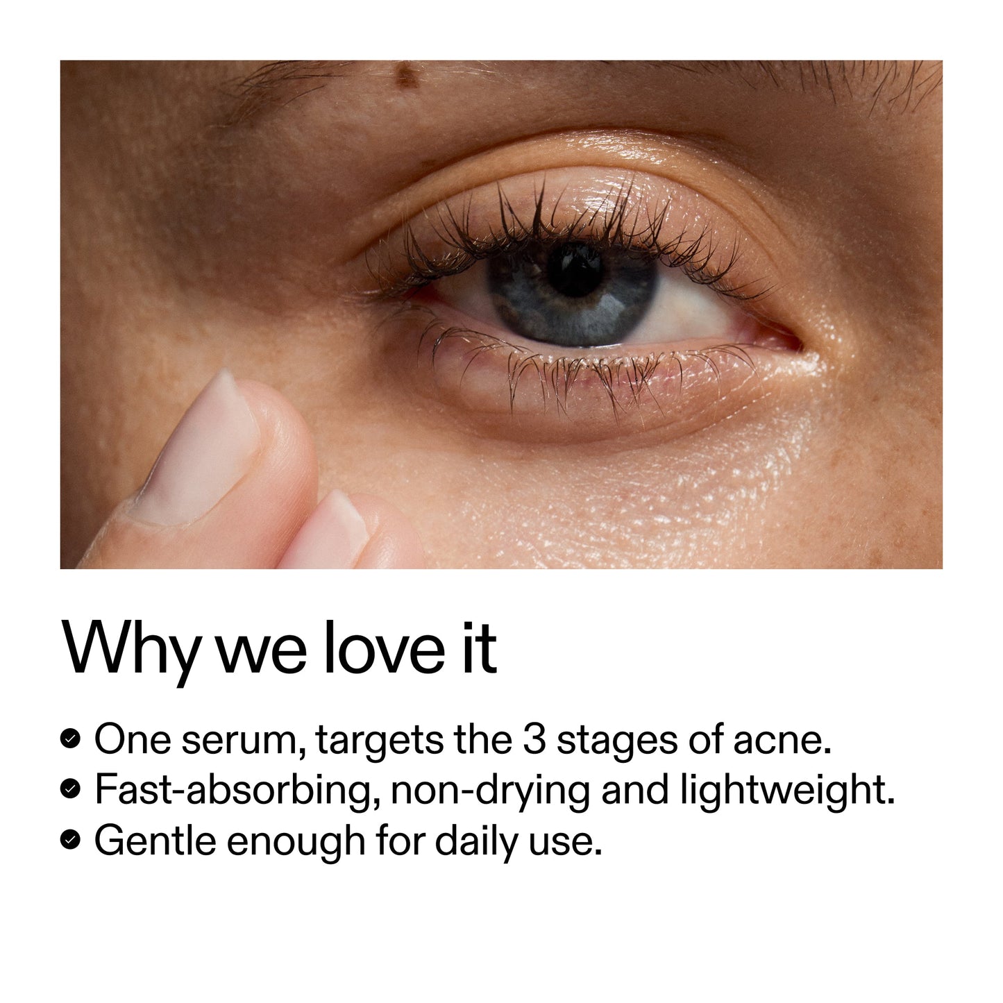 360-acne-clearing-duo-k6 Dioic_Whyweloveit_2000x2000_175aafd3-0cbe-403a-b317-a8362881bfe2.jpg