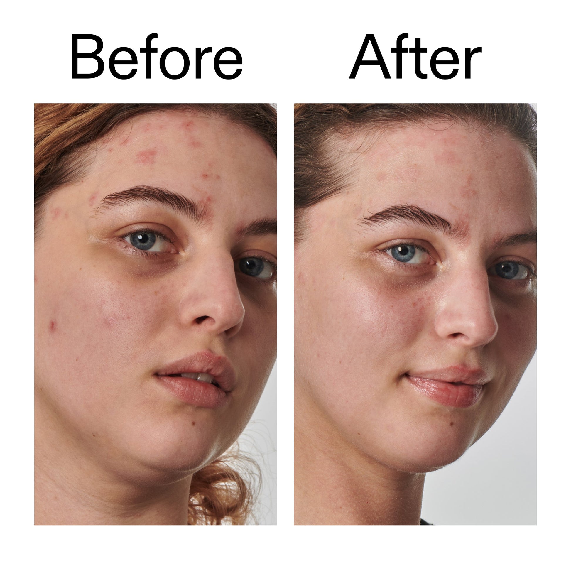 10-urea-moisturizer-l5 Dry_and_Rough_Skin_Solution_Before_After_2000x2000_efa6e639-5c39-49bd-a5dd-f0220293120a.jpg