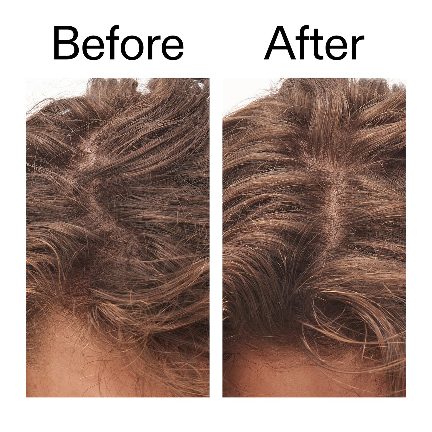 glycolic-acid-exfoliating-scalp-scrub-e5 Glycolic_Acid_Exfoliating_Scalp_Scrub_Before_After_2000x2000_b8561c87-05a1-4caa-80f7-1b6b33d750f7.jpg