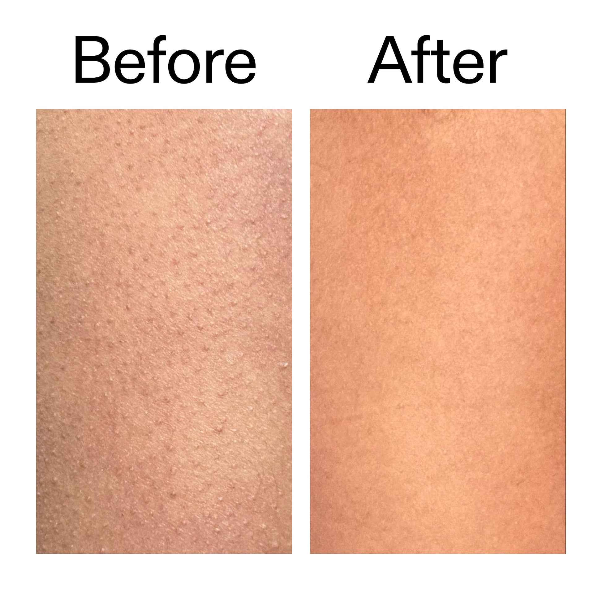 glycolic-acid-exfoliating-body-stick-t1 Glycolic_Body_Stick_B_A_2000x2000_6e6e6b4d-5bd7-43c0-aeed-4d66788e8995.jpg