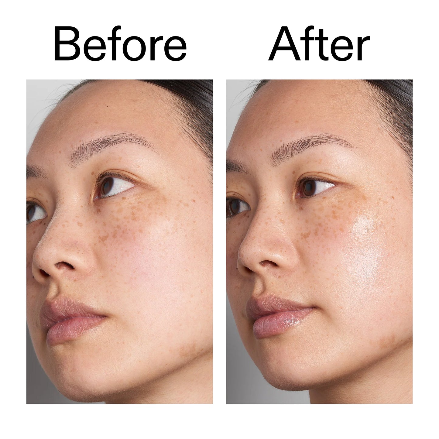 supersize-hyaluronic-acid-serum-100ml-duo-w7 Hyaluronic_Acid_Before_After_2000x2000_d7983956-8aa2-4ea3-8255-c63e8d4f892e.jpg