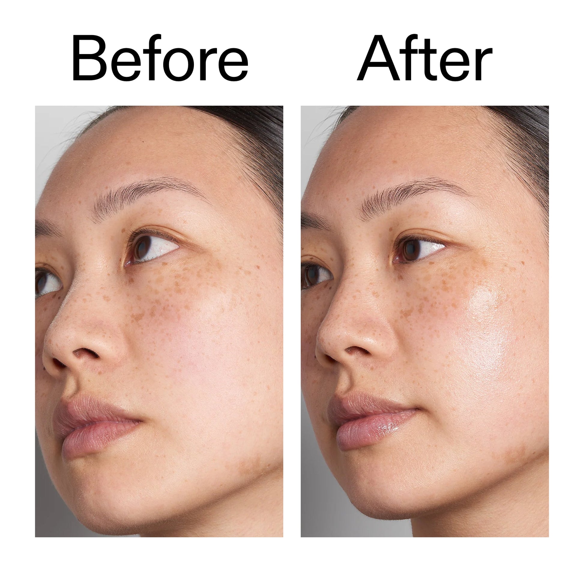supersize-hyaluronic-acid-serum-100ml-duo-w7 Hyaluronic_Acid_Before_After_2000x2000_d7983956-8aa2-4ea3-8255-c63e8d4f892e.jpg