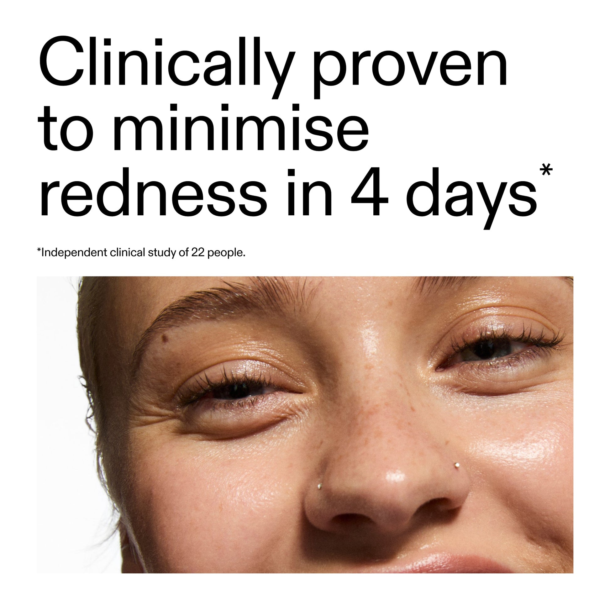 10-azelaic-acid-serum-for-redness-relief-c6 Oat_Cleansing_Balm_Claim_2000x2000_52a841dc-353c-4f2c-8646-3aadb604507d.jpg