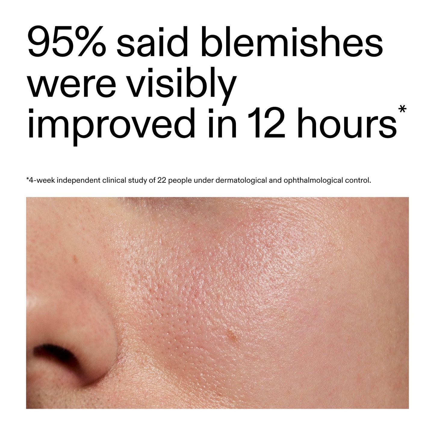 succinic-acid-acne-treatment-t5 Oat_Cleansing_Balm_Claim_2000x2000_ac6ce553-25db-41b2-a981-faae1ac4b8c0.jpg
