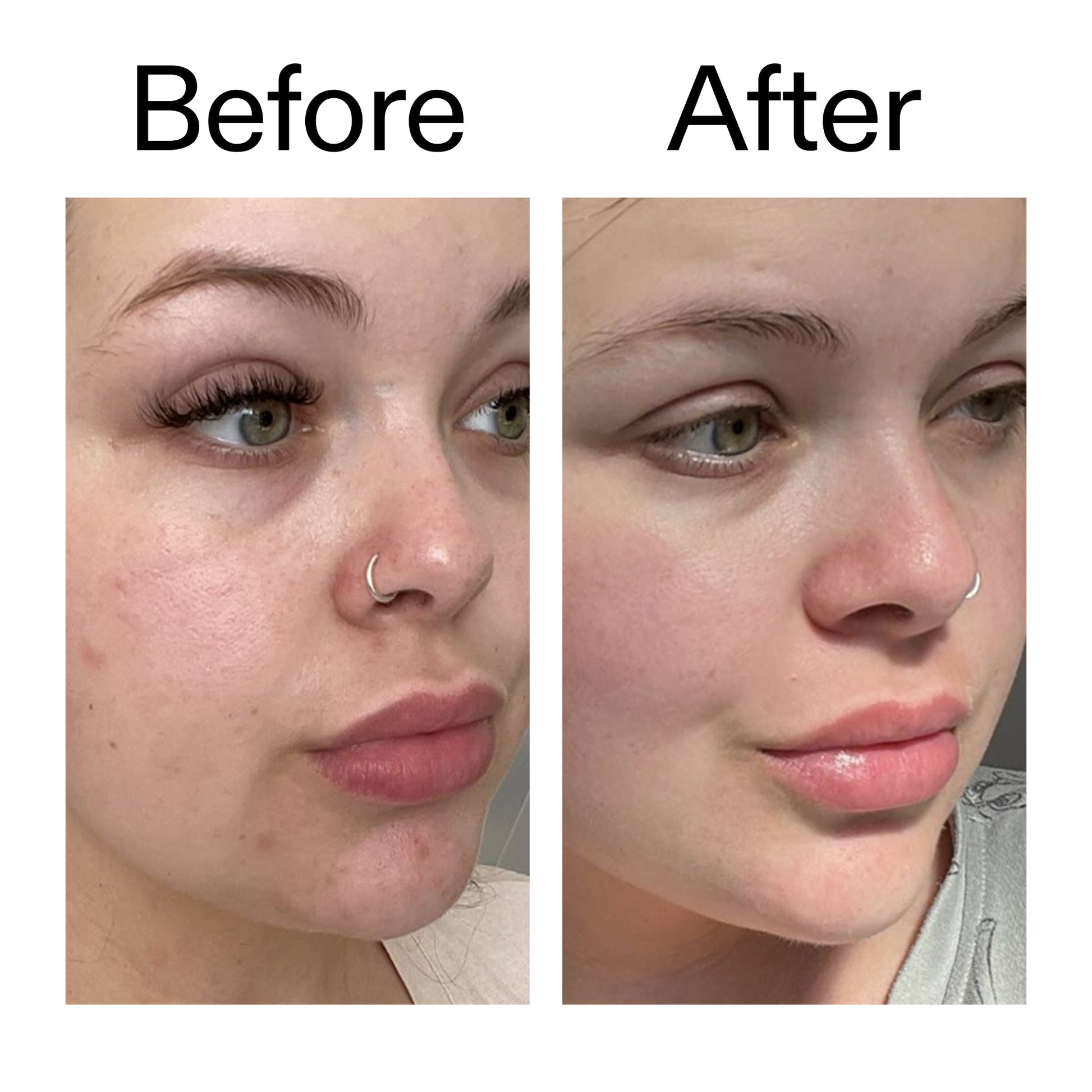 supersize-omega-water-cream-duo-a3 Omega50_Before_After_2000x2000_46483ed8-3f9d-487f-9a0c-9df79830bd65.jpg