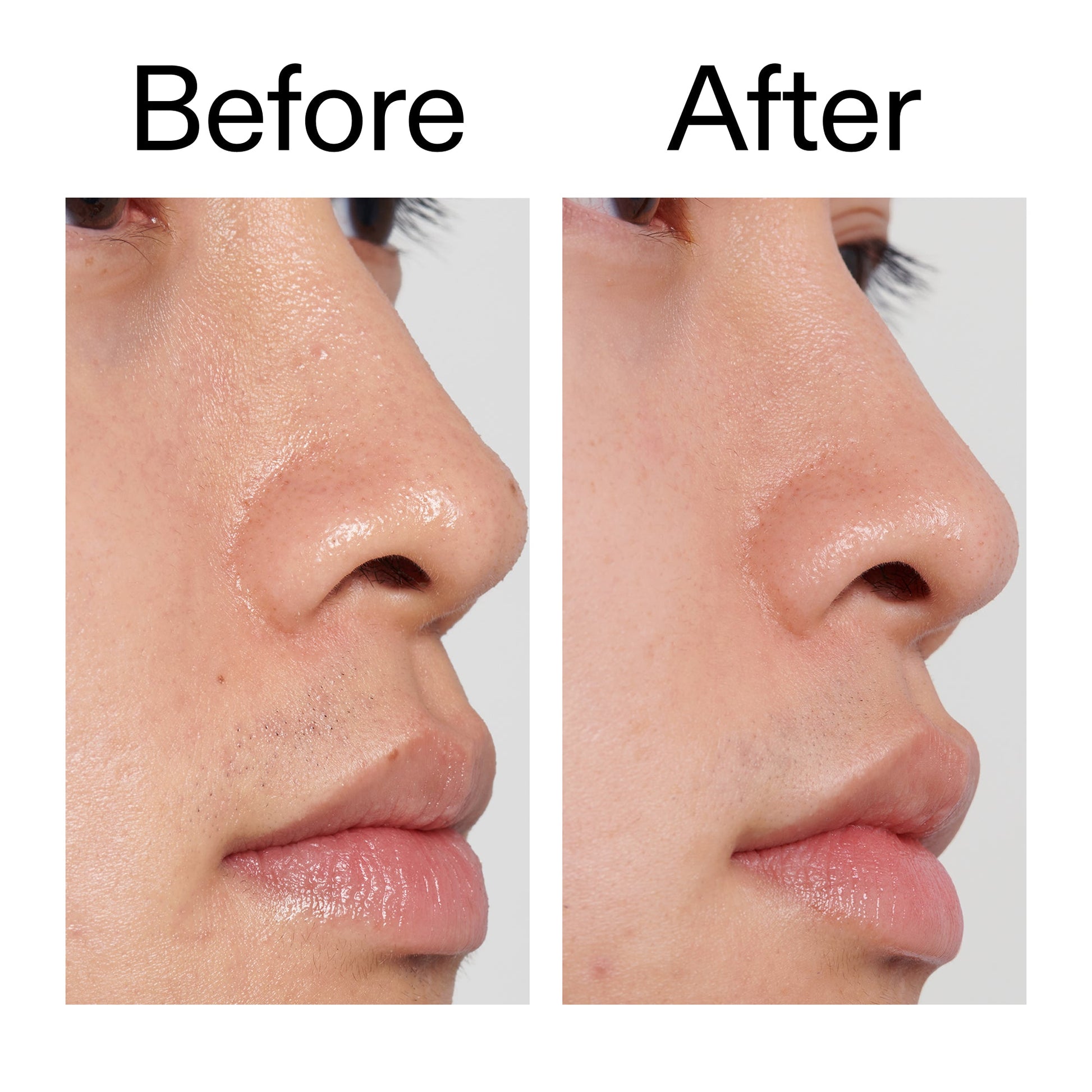 pha-toner-s6 PHA_Toner_Before_After_2000x2000_e3c10172-0150-4342-8b95-57417eaff50d.jpg