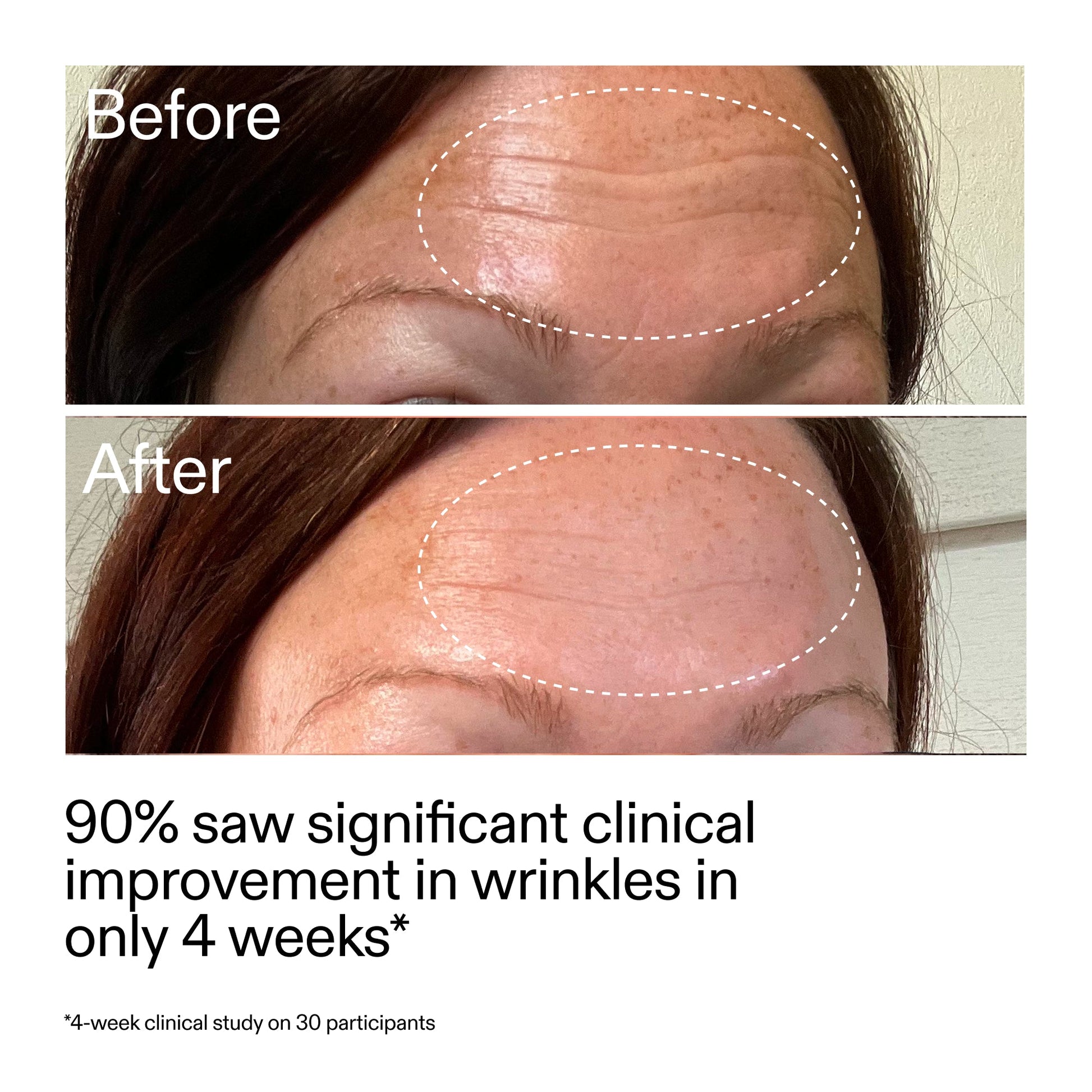 starter-retinol-serum-v2 StarterRetinol_BeforeAfter_Claim1_2000x2000_a09b50b6-4688-4527-abae-21bd142b89b7.jpg