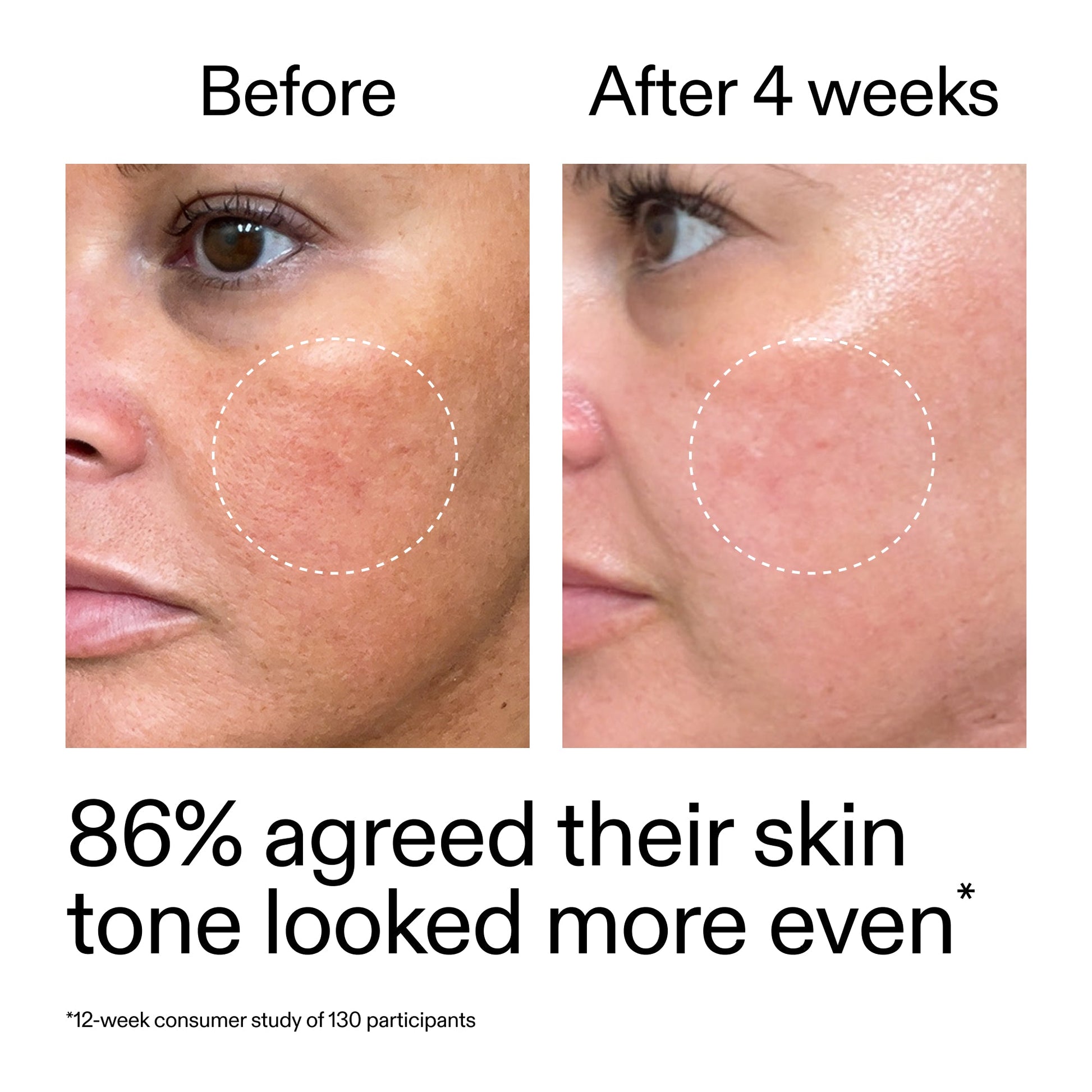 starter-retinol-serum-v2 StarterRetinol_BeforeAfter_Claim2_2000x2000_f5c9ecc0-8d76-429d-bef5-c3a61bcf5c09.jpg