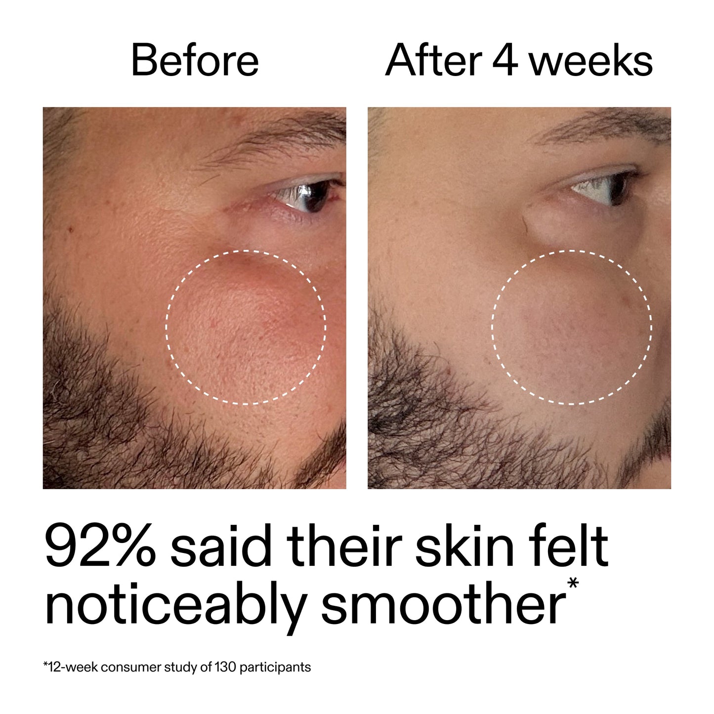 starter-retinol-serum-duo-d3 StarterRetinol_BeforeAfter_Claim3_2000x2000_458243a8-bbb0-4e5d-a274-29c7766d339b.jpg