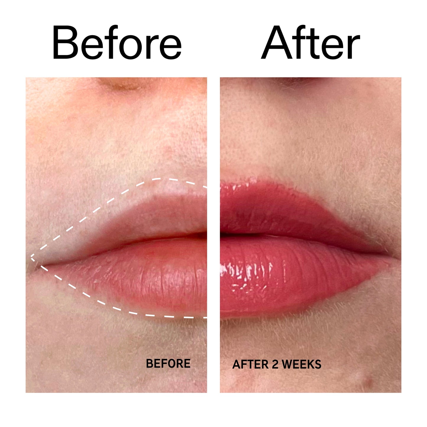 tripeptide-plumping-berry-lip-balm-c8 Tripeptide_Plumping_Lip_Balm_-_Berry_Before_After_2000x2000_9474bbd8-43ca-4b0e-b0e7-dfab70b91927.jpg